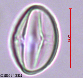 Umbilicus rupestris - lame n° 29385